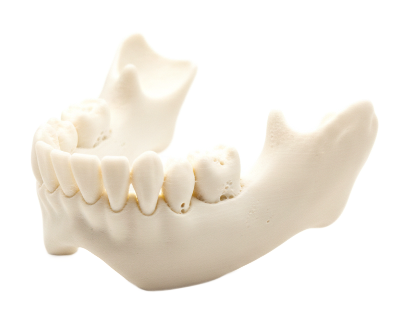 3D-printed anatomical bone model